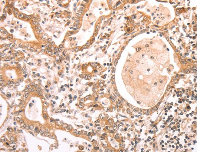ABCF1 Antibody