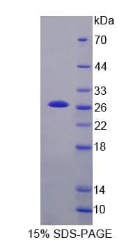 Mouse XIAP Protein (Recombinant His-S)