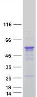 Human CPEB1 / CPEB Protein (Recombinant Myc-DDK (Flag))