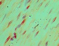 Polyclonal Rabbit anti-Human HUFI-2 / LRRFIP2 Antibody (aa150-200, IHC)