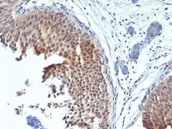 KRT6 / CK6 / Cytokeratin 6 Antibody (aa545-555, clone SPM269)