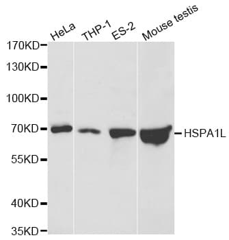 Polyclonal Rabbit anti-Human HSPA1L Antibody (IHC, IF, WB)