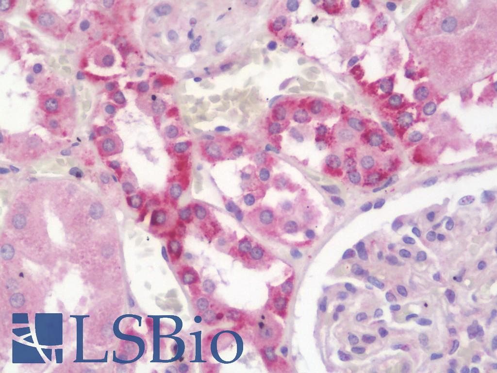 IHC-plus™ Polyclonal Rabbit anti-Human ABCC2 / MRP2 Antibody (aa977-1026, IHC, WB)