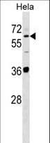 SUOX / Sulfite Oxidase Antibody (aa160-187)
