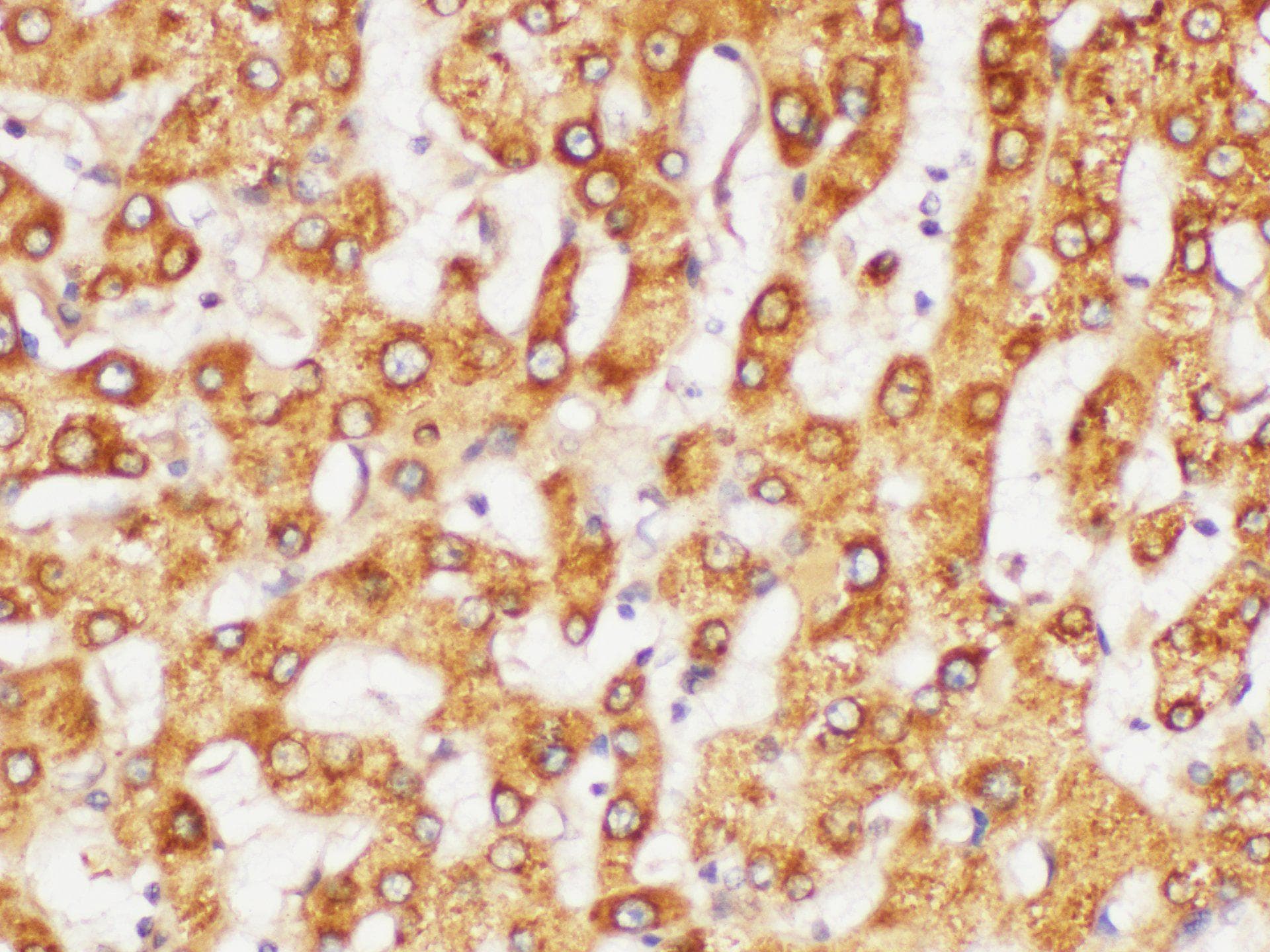 FGG / Fibrinogen Gamma Antibody