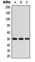 ARRB1 / Beta Arrestin 1 Antibody (C-Terminus)