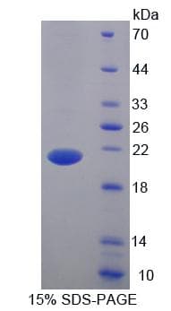 Mouse BTLA / CD272 Protein (Recombinant His-T7)