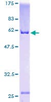 Human ANXA2 / Annexin A2 Protein (Recombinant GST)