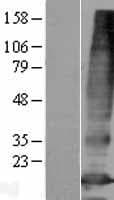 PQLC3 Protein (Over-Expression Lysate Myc-DDK (Flag))