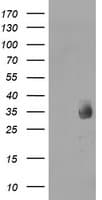MMACHC Antibody (clone OTI1B7, Carrier-free)