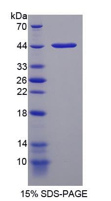 Human NMU / Neuromedin U Protein (Recombinant His-GST)