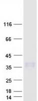 Human PRSS58 Protein (Recombinant Myc-DDK (Flag))