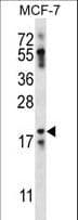 NRN1L Antibody (aa40-69)