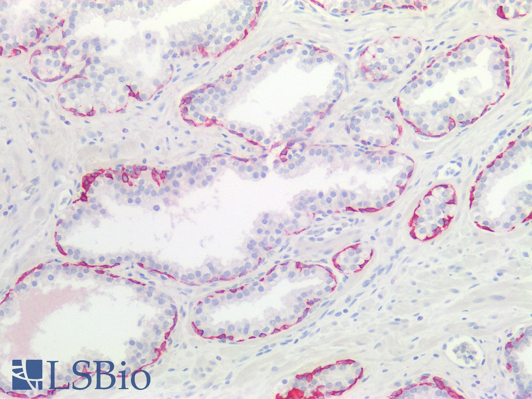 PathPlus™ KRT17 / CK17 / Cytokeratin 17 Antibody