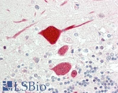 IHC-plus™ KCNC1 / Kv3.1 Antibody (Internal)