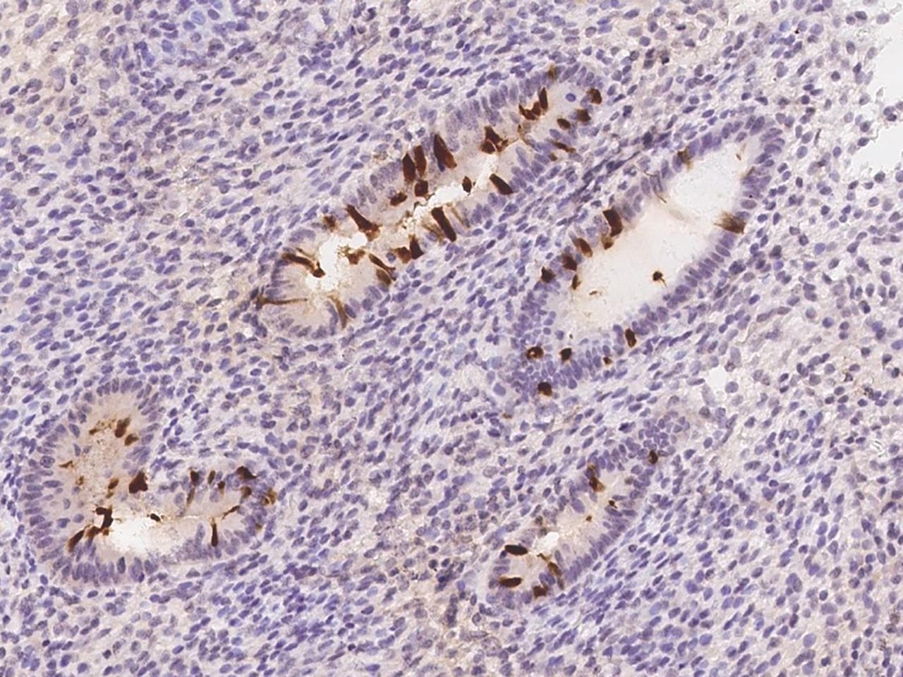 LRRC46 Antibody