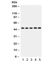 Polyclonal Rabbit anti-Human YBX1 / YB1 Antibody (IHC, WB)