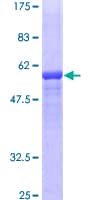 Human F12 / Factor XII Protein (Recombinant GST)