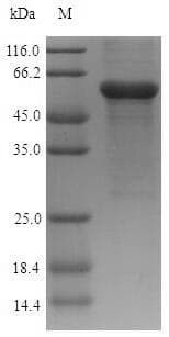 Human ASAH1 / Acid Ceramidase Protein (Recombinant 6His-SUMO, N-terminus)