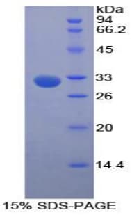 Human GLA / Alpha Galactosidase Protein (Recombinant His-S)