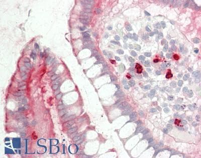 IHC-plus™ Polyclonal Rabbit anti-Human MYH14 Antibody (aa654-668, IHC, WB)