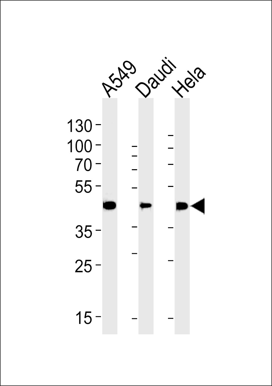 Polyclonal Rabbit anti-Human ALDH3A1 Antibody (aa254-284, IHC, WB)