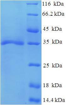 Human gH / Envelope Glycoprotein H (Recombinant His-SUMO)