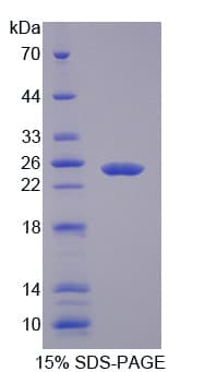 Human MAC-2-BP / LGALS3BP Protein (Recombinant His, N-Terminal)