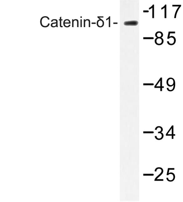 Polyclonal Rabbit anti-Human CTNND1 / p120 Catenin Antibody (Gly224, IHC, WB)