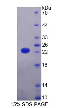 Human KDM4A / JHDM3A / JMJD2A Protein (Recombinant His-T7)