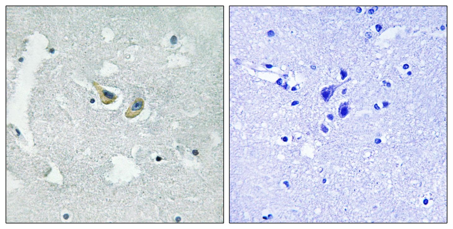 NCF1 / p47phox / p47 phox Antibody (phospho-Ser345)