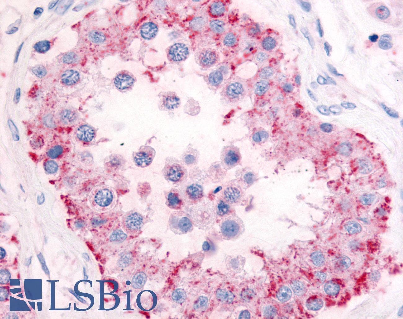 IHC-plus™ PDE11A Antibody (Internal)