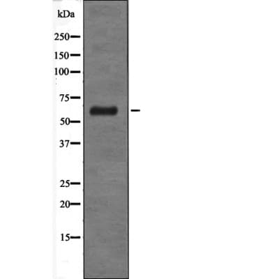 GABRD Antibody