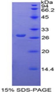 Rat PKM / Pyruvate Kinase, Muscle Protein (Recombinant His-T7)
