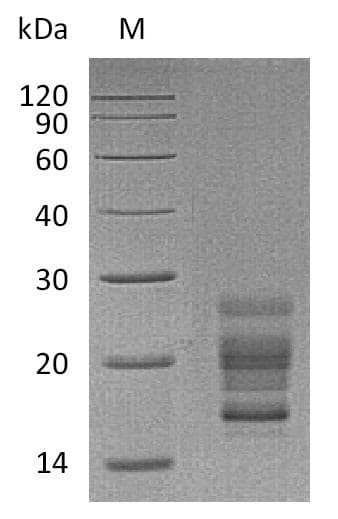 Mouse IL17A Protein (Recombinant 6His, C-terminus)