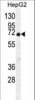 C11orf95 Antibody (aa556-584)