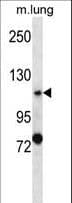 Polyclonal Rabbit anti-Human PKD2 / Polycystin 2 Antibody (aa874-903, WB)