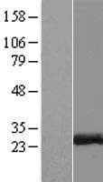 ZCCHC10 Protein (Over-Expression Lysate Myc-DDK (Flag))