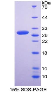 Rat CCS Protein (Recombinant His-T7)