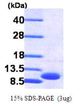 Human CXCL3 / GRO Gamma Protein (Recombinant His)