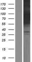 C14orf169 / NO66 Protein (Over-Expression Lysate Myc-DDK (Flag))