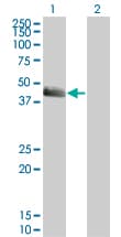 Monoclonal Mouse anti-Human SERPINE1 / PAI-1 Antibody (clone 3F2, WB)