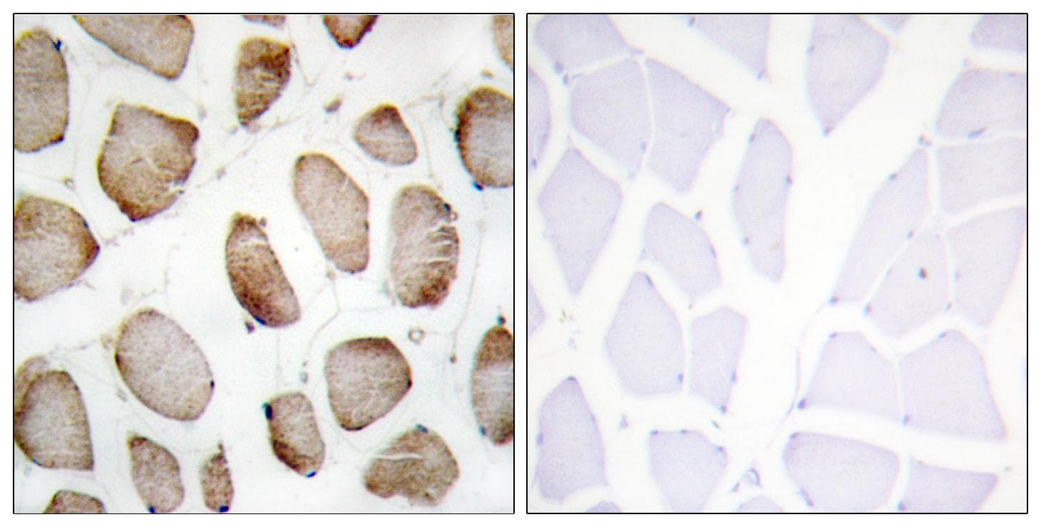 DUS2 / DUS2L Antibody