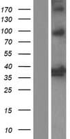 Human HMOX2 / Heme Oxygenase 2 Protein (Over-Expression Lysate Myc-DDK (Flag))