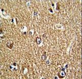 FMR1 / FMRP Antibody (aa20-48)