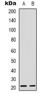 RHOG / ARHG Antibody (Internal)