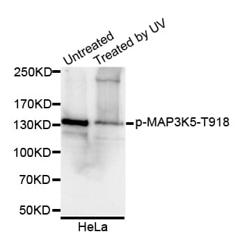 MAP3K5 / ASK1 Antibody (phospho-Thr918, AP)