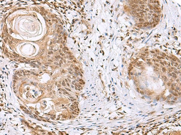 ELAC1 Antibody