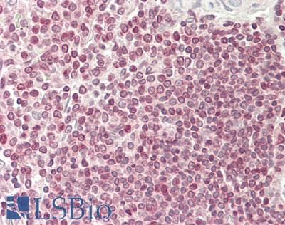 IHC-plus™ ARID4B Antibody (aa125-175)
