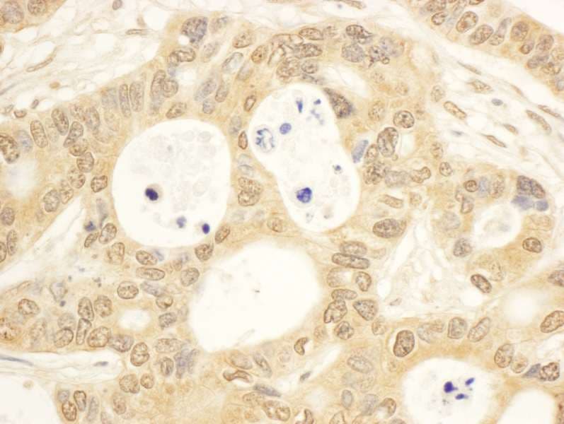 CIAPIN1 / Anamorsin Antibody (aa100-150)